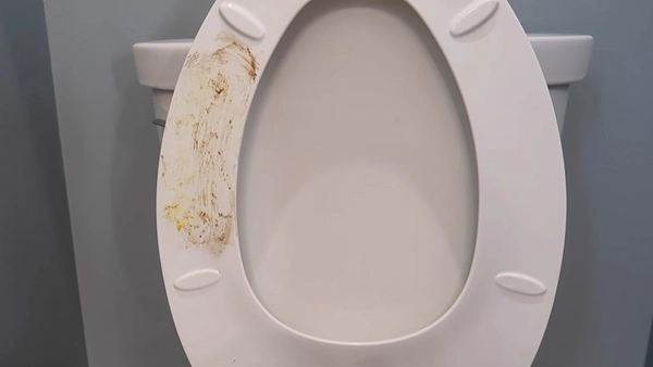 how-to-clean-poop-stains-from-toilet-bowl-9-steps-helpful