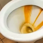 How to Remove Yellow Stains From Toilet: 5 Methods [DIY]