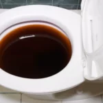 What to Do if Poop Is Stuck in Toilet