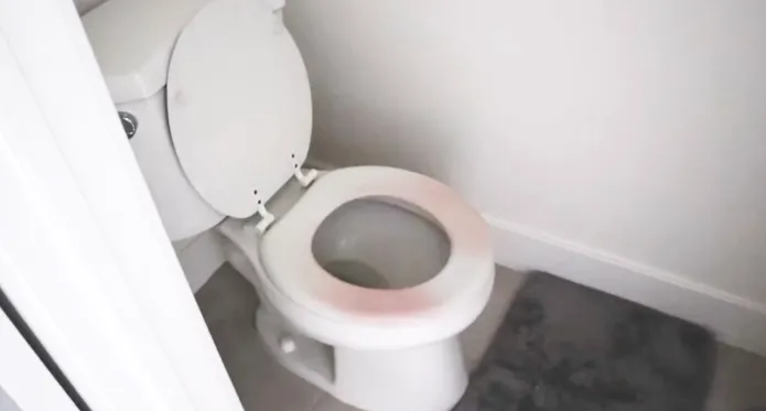Why Is My Toilet Seat Turning Pink: 5 Reasons