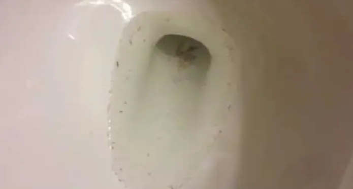 How to Get Rid of White Worms in Bathroom